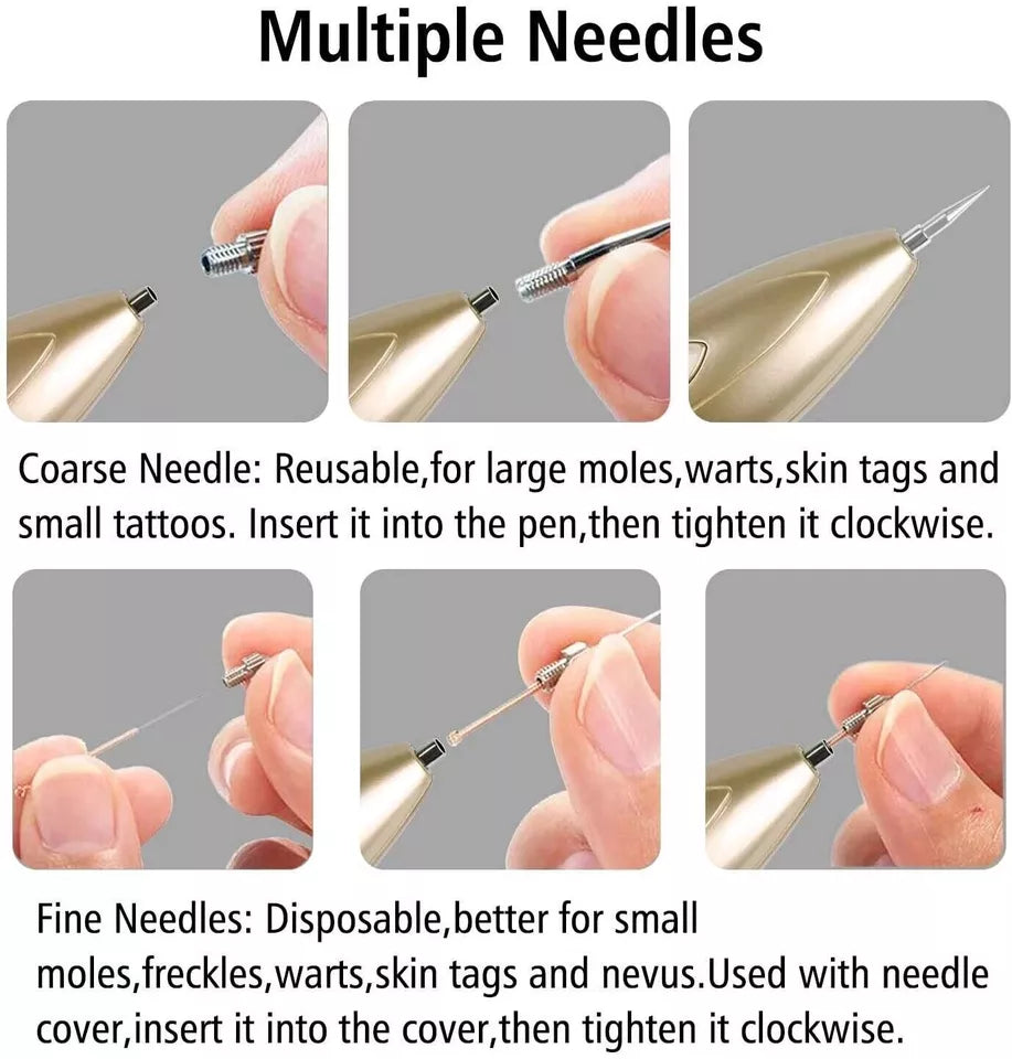 Precision Skin Tag & Mole Remover Pen – Rechargeable Spot Eraser