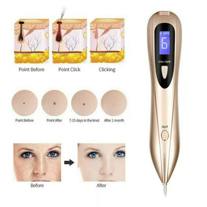 Precision Skin Tag & Mole Remover Pen – Rechargeable Spot Eraser